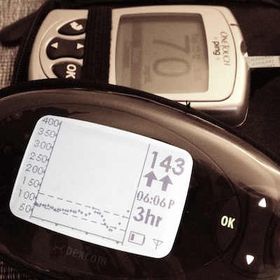 Dexcom showing double straight up arrows